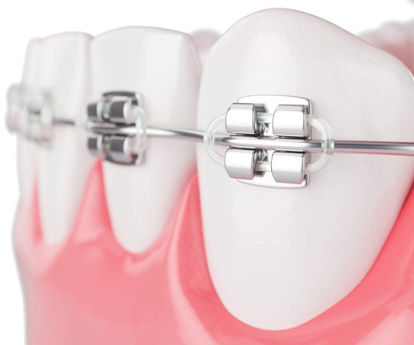 cierrese-encima-dientes-salud-belleza-abrazadera-enfoque-selectivo-renderizado-3d